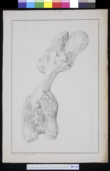 M. Houtman, Pathology, fractures (Femur)