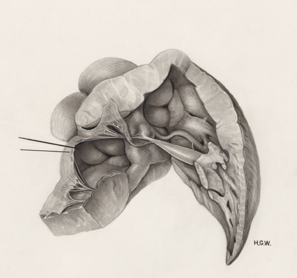 H.G Wetselaar, Heart and adjacent organs