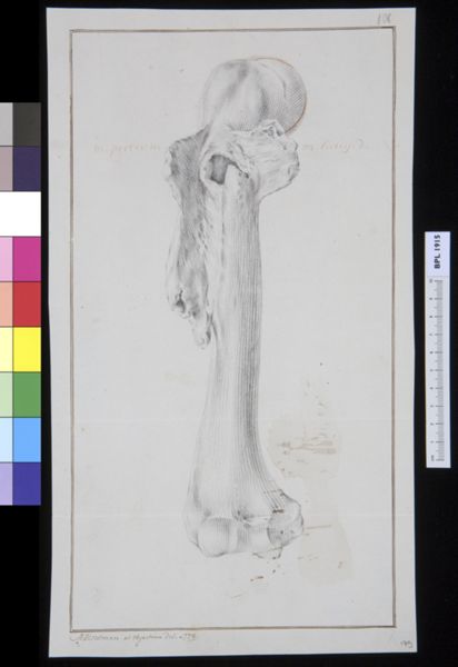 M Houtman, Infected bone (femur?)