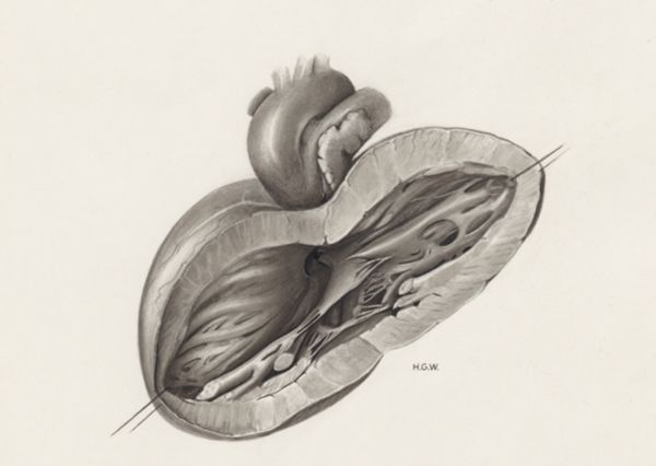 H.G Wetselaar, Heart and adjacent organs