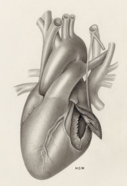 H.G Wetselaar, Heart