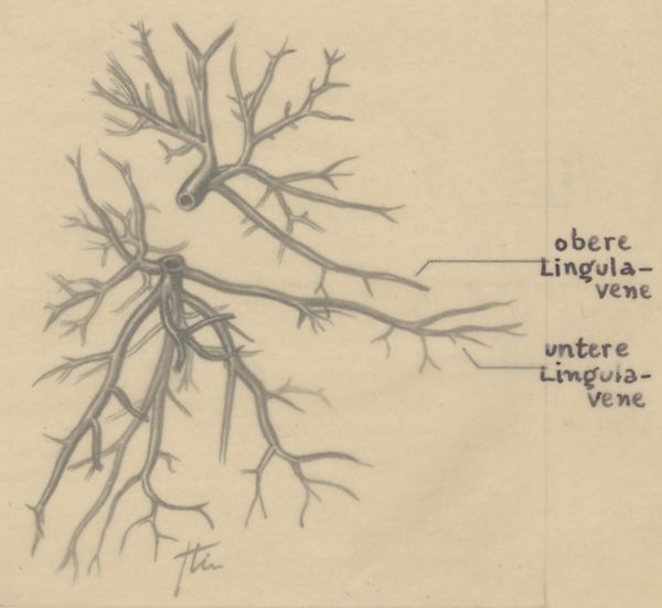 J Tinkelenberg, Bronchi