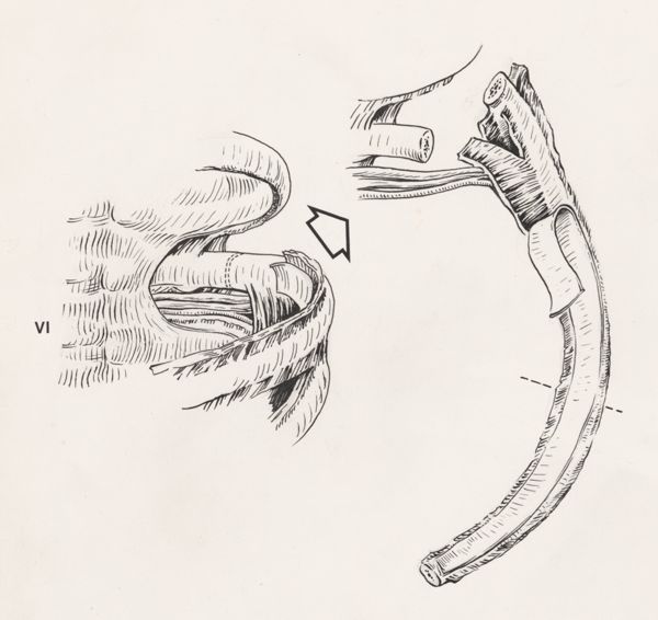 J Tinkelenberg, Orthopedic surgery