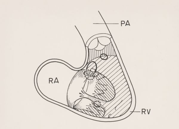 J Wetselaar-Whittaker, Cardiovascular system