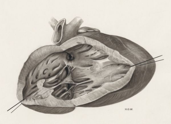 H.G Wetselaar, Heart and adjacent organs