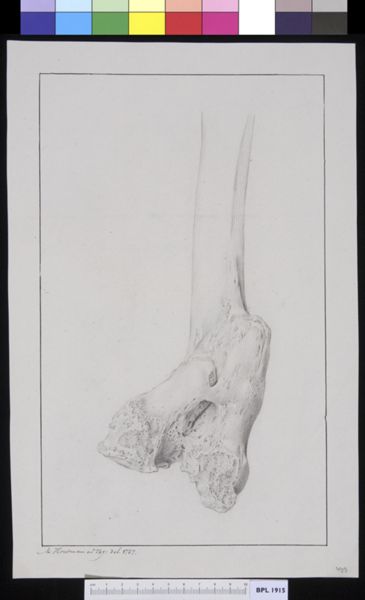M Houtman, Femur or fibula with fracture