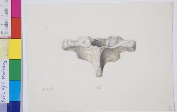 Tiemen Hooiberg, Pathology, vertebra
