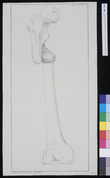 M Houtman, Femur: fracture