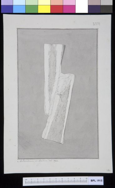 M Houtman, Infected bone