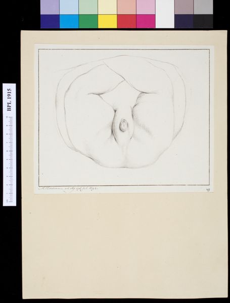 M Houtman, Genitals, hermaphrodite