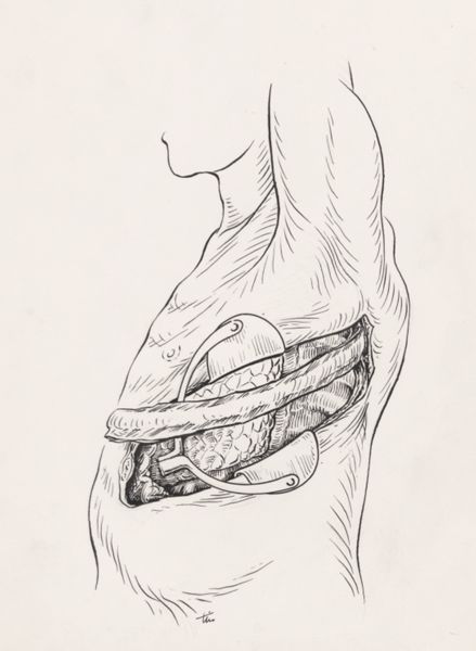 J Tinkelenberg, Orthopedic surgery