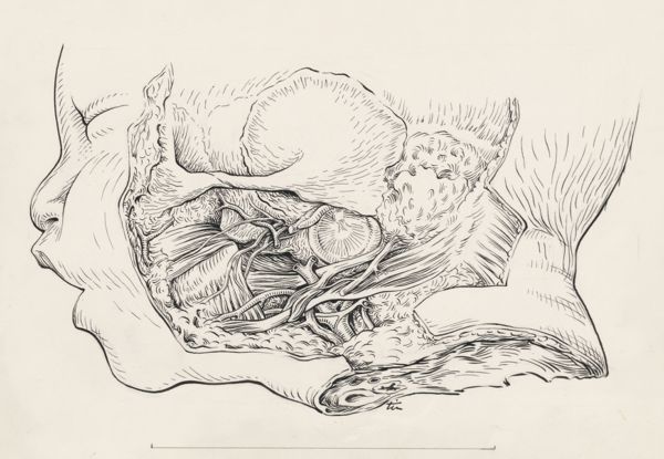 J Tinkelenberg, Vascular system of an infants head
