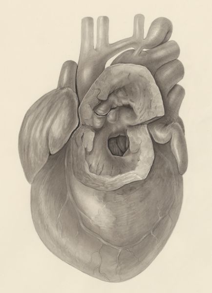 H.G Wetselaar, Heart