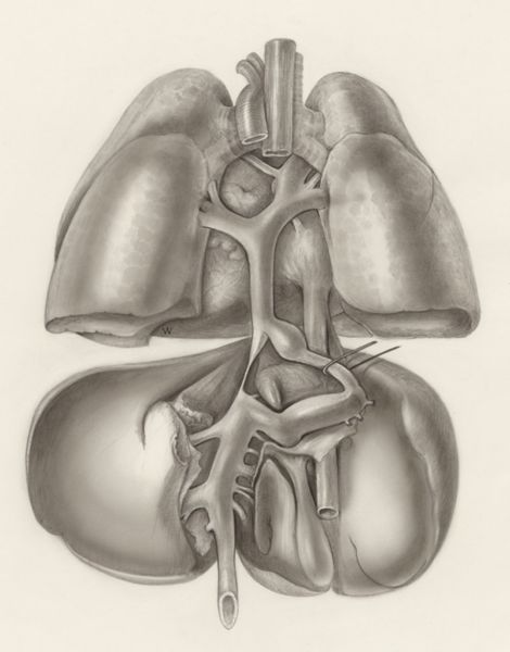 H.G Wetselaar, Heart and adjacent organs