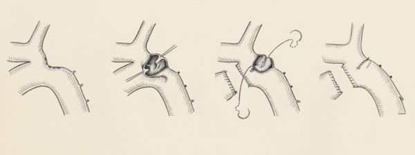 J Wetselaar-Whittaker, Cardiovascular system