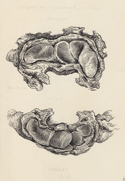 J Tinkelenberg, Musculoskeletal system of the hand and wrist