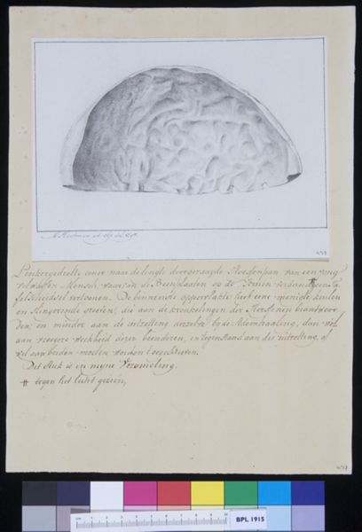 M Houtman, Calvaria (skull)
