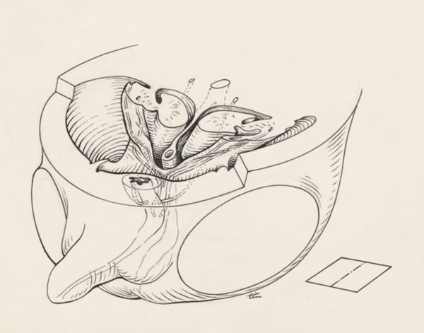 J Tinkelenberg, Cross section of the human embryo