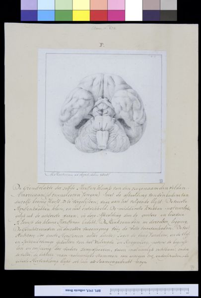 M Houtman, Brain