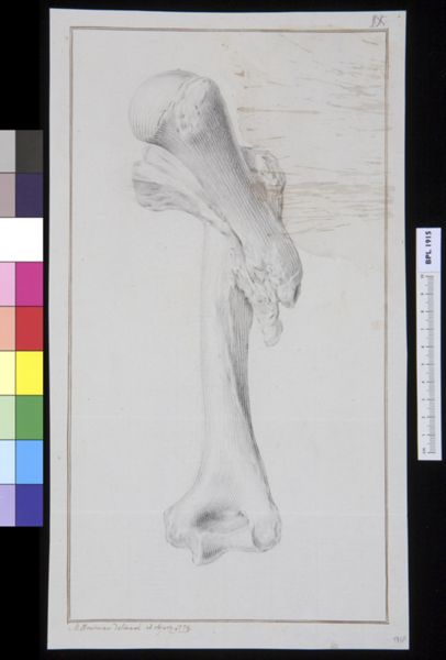 M Houtman, Infected bone (femur?)