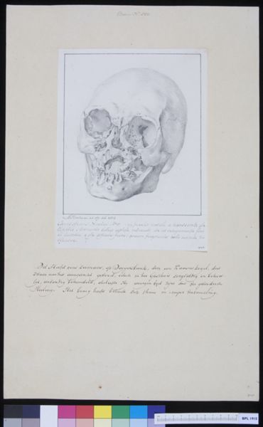 M Houtman, Skull of a man with trauma