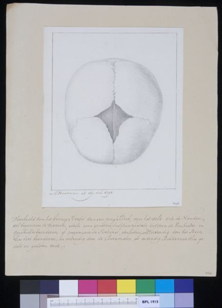 M Houtman, Calvaria (skull)