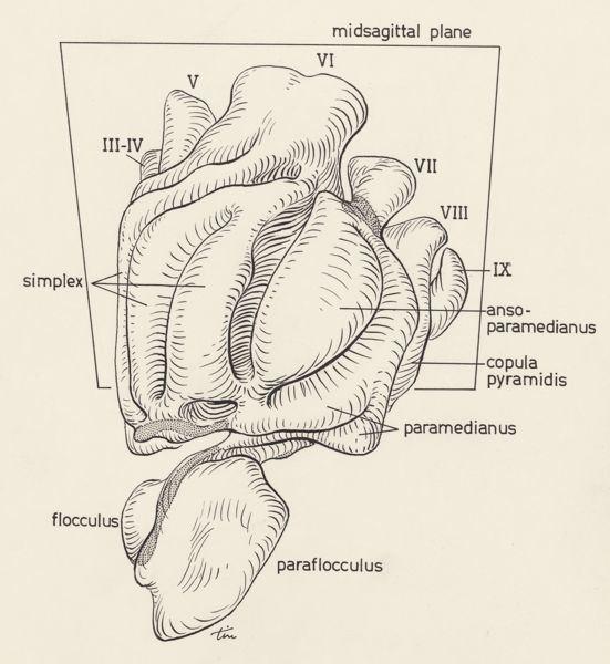 J Tinkelenberg, Cerebral tissue