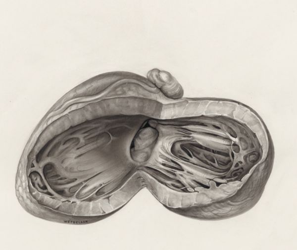 H.G Wetselaar, Heart and adjacent organs