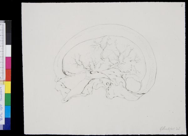 Gerard Sandifort, Skull, cross section