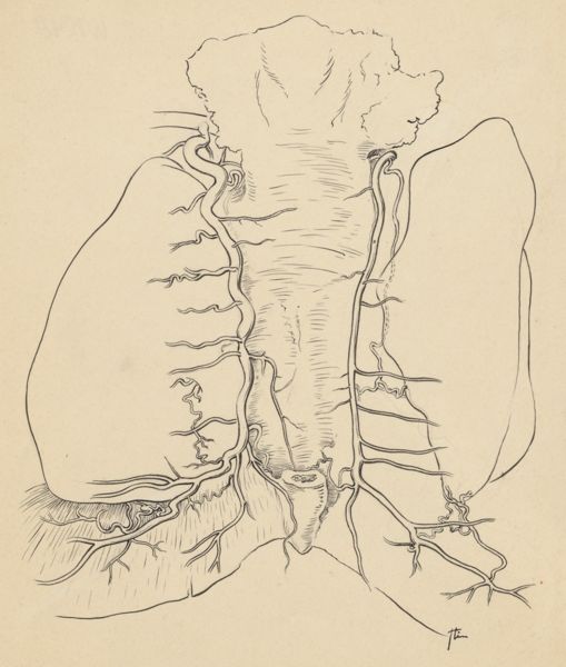 J Tinkelenberg, Part of the heart and circulatory system