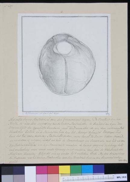M Houtman, Skull of a child, hernia