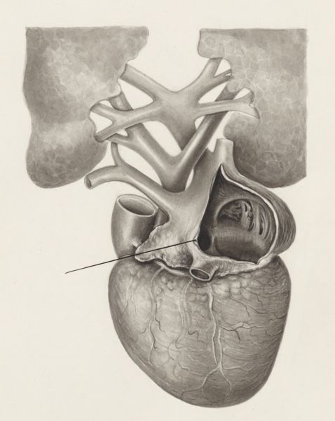 H.G Wetselaar, Heart and adjacent organs