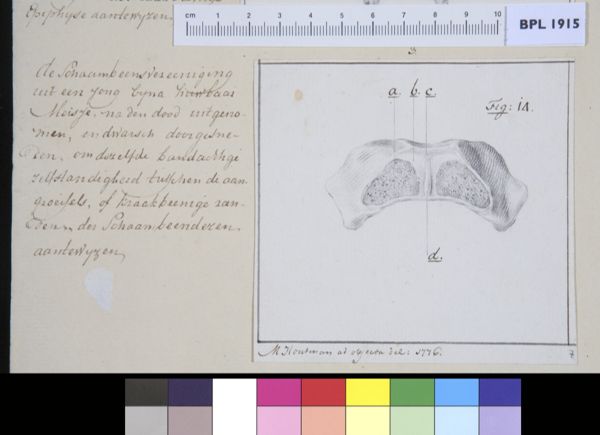 M Houtman, Pubis bone