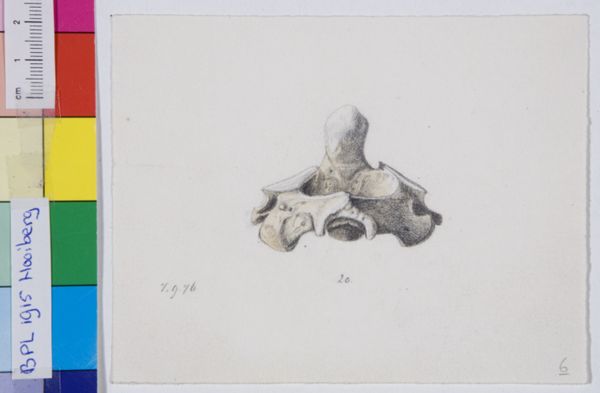 Tiemen Hooiberg, Pathology, vertebra