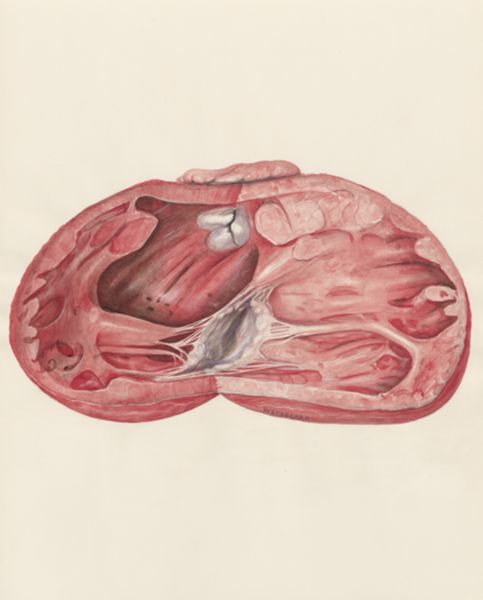 H.G Wetselaar, Heart