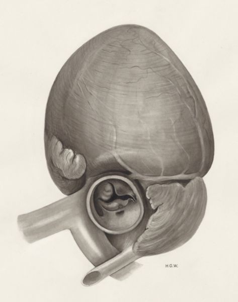 H.G Wetselaar, Heart and adjacent organs