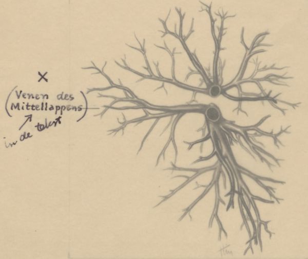 J Tinkelenberg, Bronchi