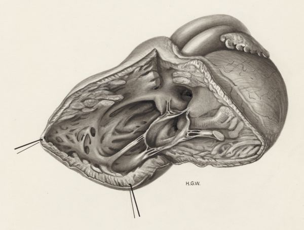H.G Wetselaar, Heart
