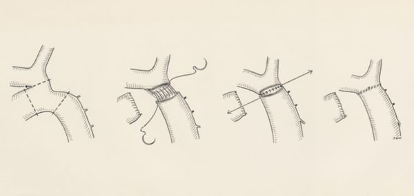 J Wetselaar-Whittaker, Cardiovascular system