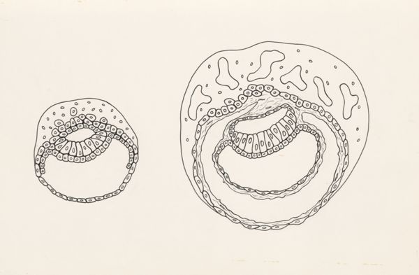 J Wetselaar-Whittaker, Schematic representation of indistinct human tissue