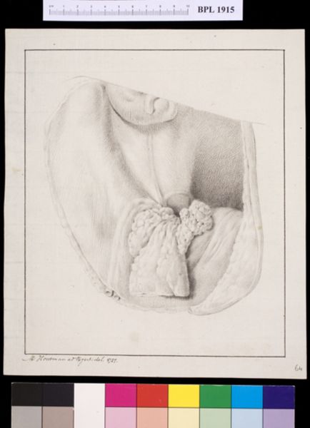 M Houtman, Bladder?