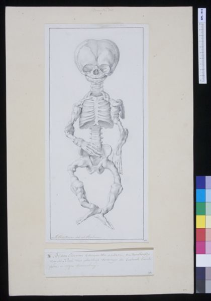 M Houtman, Skeleton of a child