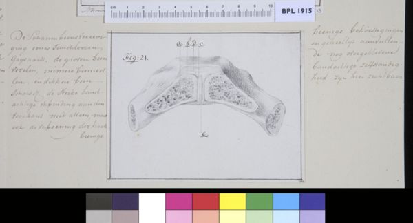 M Houtman, Pubis bone