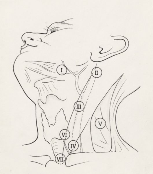 J Tinkelenberg, Neck surgery