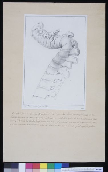 M Houtman, Torsioned vertebrae