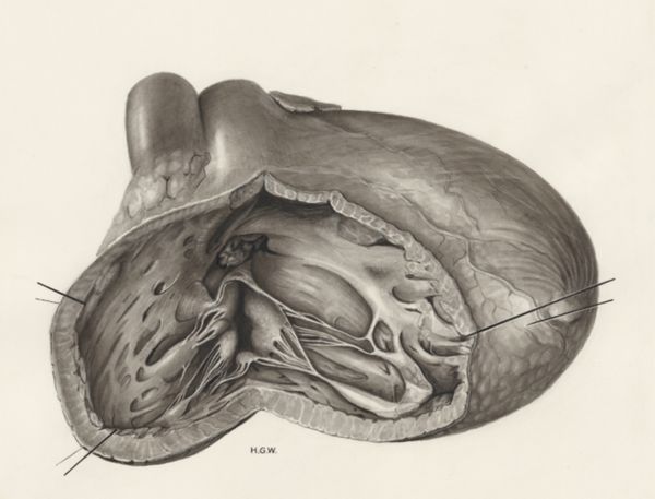 H.G Wetselaar, Heart