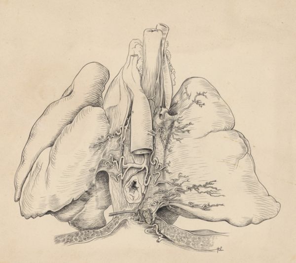 J Tinkelenberg, Heart and adjacent organs