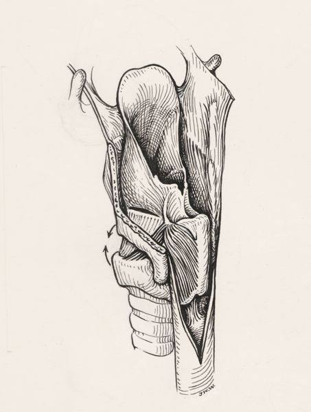 J Wetselaar-Whittaker, Esophagus
