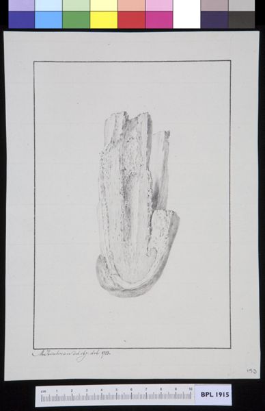 M Houtman, Infected bone
