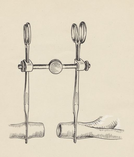 J Tinkelenberg, Vascular surgery